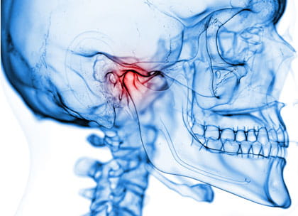 Anatomical image of TMJ joint